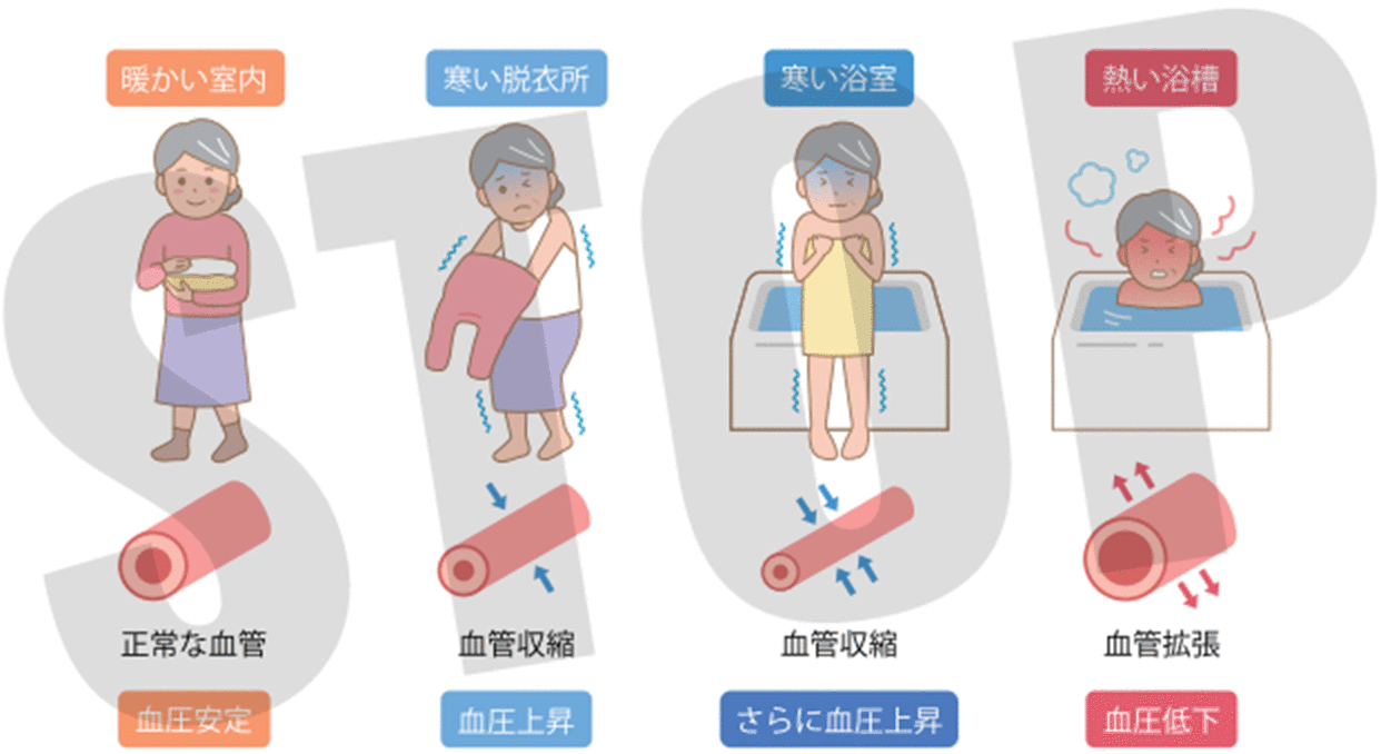 暖かい室内→血圧安定、寒い脱衣所→血圧上昇、寒い浴室→さらに血圧上昇、熱い浴槽→血圧低下